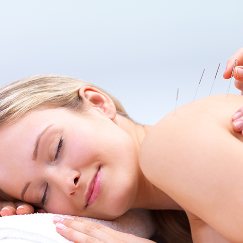 Chiropractic Altoona PA Benefits of Acupuncture