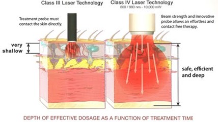 Chiropractic Altoona PA Diagram